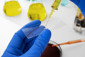 AulaPlus Formación Detectar el cáncer de vejiga será tan fácil como hacer pis